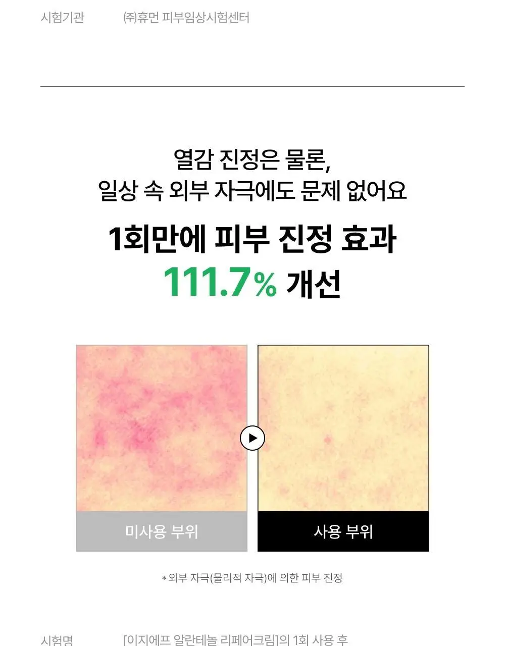 [단독기획/트러블1위] 셀인샷 알란테놀 트러블 크림 70ml 기획 (+크림 20ml*2) 상세페이지 14